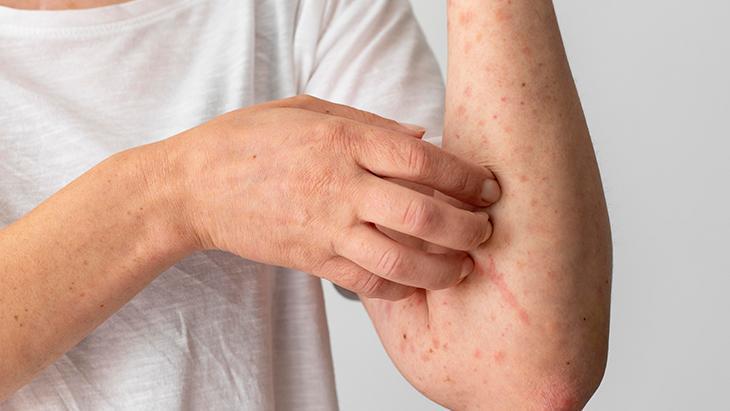 Balık Tüketimi ve Protein Kaynakları Hakkında Detaylı Bilgilendirme