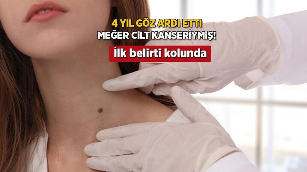 Cilt Kanseri ve Erken Teşhisin Önemi: Jane Murray’nin Hikayesi