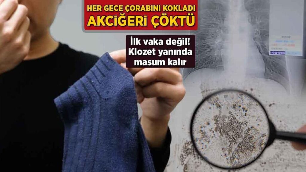 Çin’de Çorap Takıntısı ve Aspergillus Mantarının Tehlikeleri