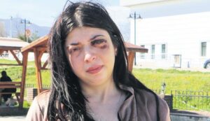 Damla Korkmaz’ın Yaşadığı Taciz ve Sonrası Olaylar