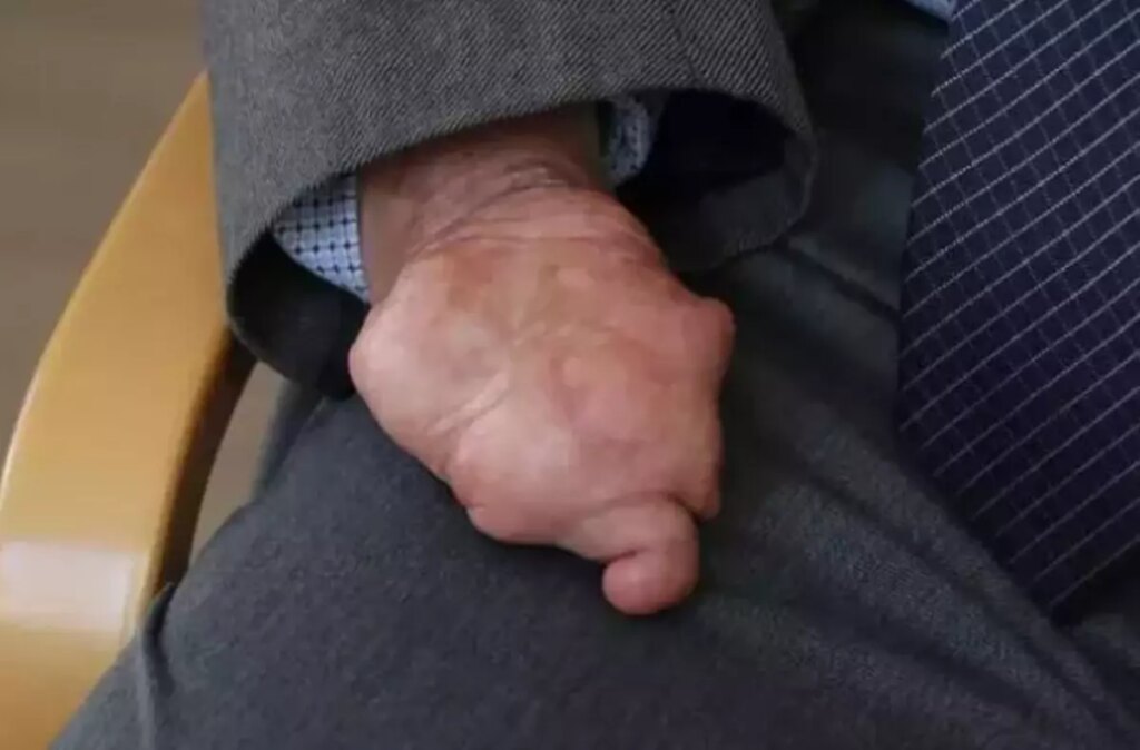 Hayat Mücadelesiyle İlham Veren Biyoloji Öğretmeni Fethi Ahmet Öner’in Uluslararası Başarısı