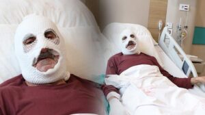 İstanbul’dan Bingöl’e Giden Talihsiz Kaza: Tüp Patlaması ve Yanıklar