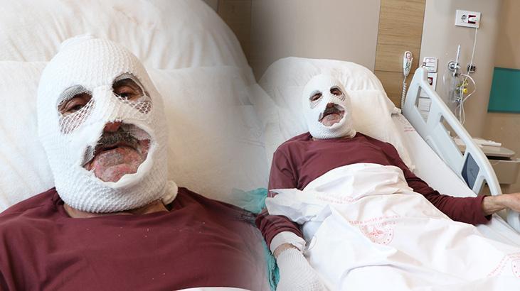 İstanbul’dan Bingöl’e Giden Talihsiz Kaza: Tüp Patlaması ve Yanıklar