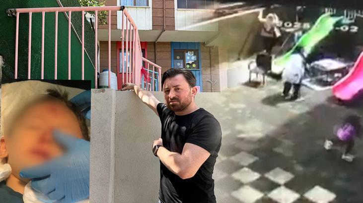 Kreşte skandal olay! ‘Ufak bir kaza’ diye aradılar, aile gerçeği öğrendi şoka girdi