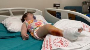 İstanbul Güngören’de Çocuk Yanıkları: Olayın Detayları ve Uzman Görüşleri