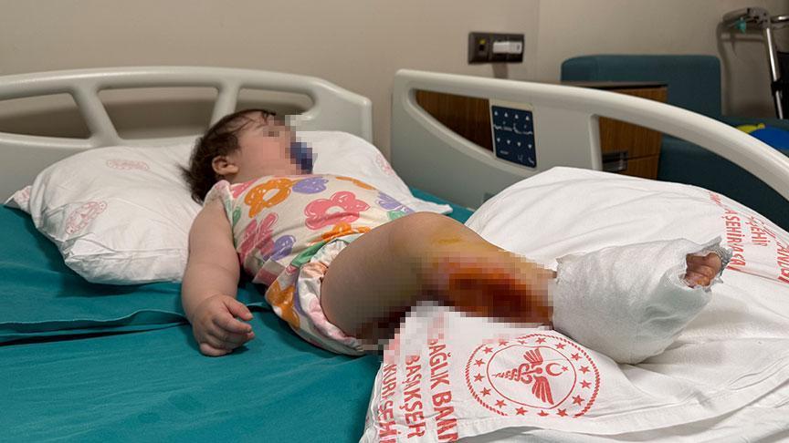 İstanbul Güngören’de Çocuk Yanıkları: Olayın Detayları ve Uzman Görüşleri