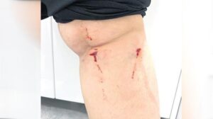 Üniversite Kampüsünde Başıboş Köpeklerle Mücadele Çalışmaları