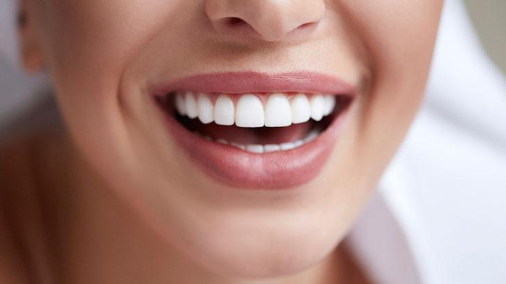 Diş Beyazlatmada Dikkat Edilmesi Gerekenler ve Beslenmenin Rolü