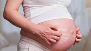 Hamilelikte kaşıntı normal mi, riskli mi? ‘El içi ve ayak tabanı bir alarm’