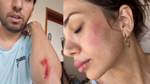 Köpek besledi dehşeti yaşadı! Veteriner ve ailesine şok saldırı: Annem 10 metre sürüklendi