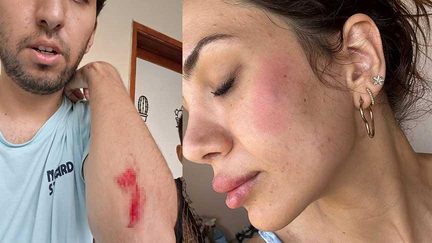 Köpek besledi dehşeti yaşadı! Veteriner ve ailesine şok saldırı: Annem 10 metre sürüklendi