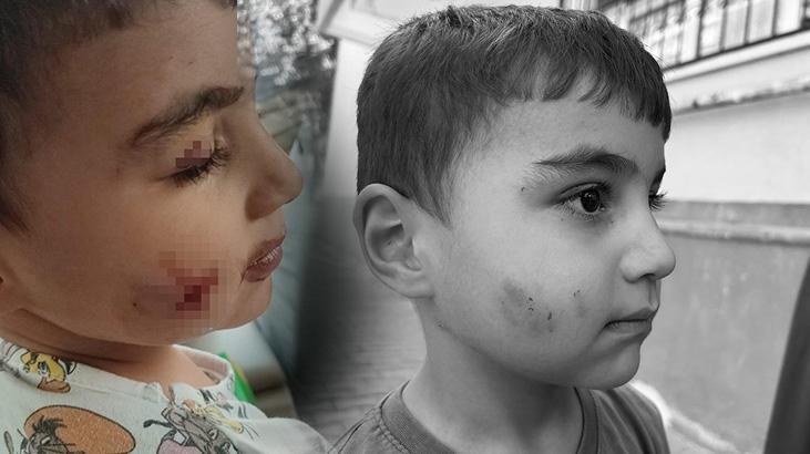 Lağım Faresinin Evde Isırması: Aile ve Belediye Talepleriyle İlgili Ayrıntılı Bilgilendirme