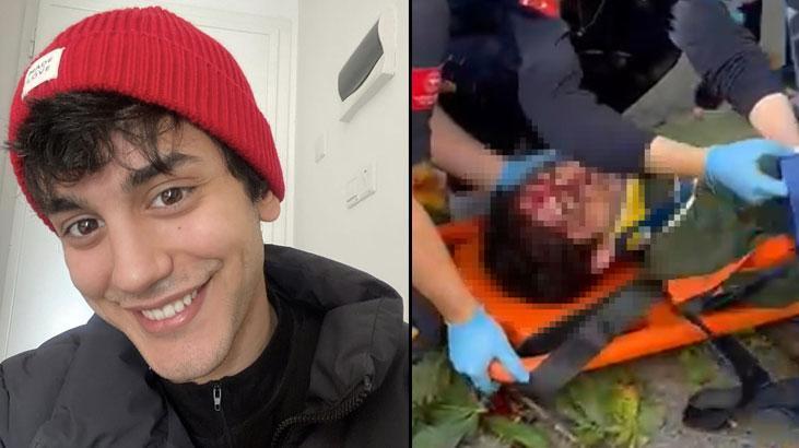 Oyuncu İbrahim Yıldız’ın üzerine ağaç devrildi! Hastaneye kaldırılan oyuncu ölüm kalım savaşı veriyor