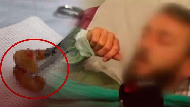 Uykuda diş kâbusu! Aynada fark etti, ciğerinden çıktı: ‘Çok sık görmeye başladık’