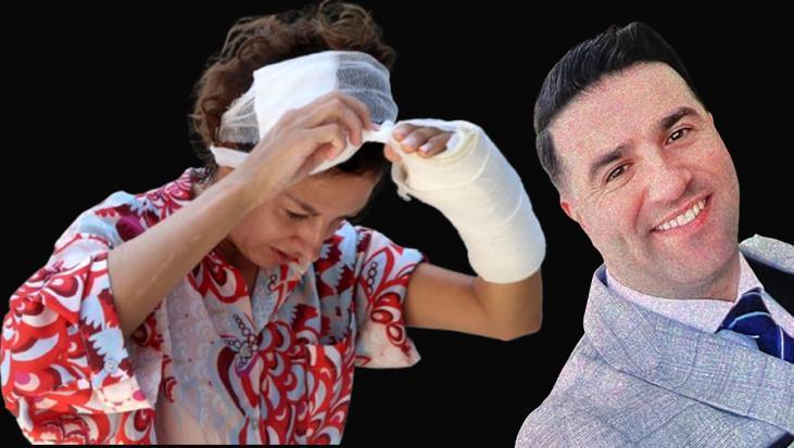 Antalya’da Eşini Sopayla Vurarak Yaralanan Kadına Dair Duruşma: Tutuklu Sanığın İddiaları ve Savunması