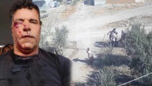 Çiçekalan’da Sondaj Kuyusu Tartışması: Müslüm Y.’ye Yönelen Şiddet Olayı