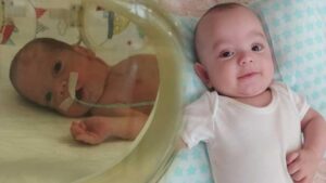 Eskişehir’deki Prematüreik İkizlikte Kuvöz Düşmesi ve Serebral Palsi Tanısı: Aile 2 Yıllık Mücadele ve Hukuki Sorgulamalar