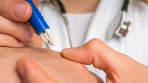 SCÜ Rektörü Şengönül: KKKA ile Mücadelede Yıl Boyu Kene Kontrolü ve Başarı Oranları