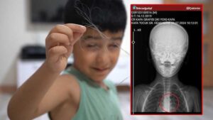 Şırnak’tan Diyarbakır’a Uzanan Tedavi Krizi: Kateterin Unutulması ve Ardındaki İzdüşüm