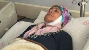 Tükürük Bezi Kitlesi ve Yüz Felci: Operasyonla İyileşmeye Giden Uzun Yol