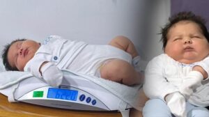 37 Haftalık Sezaryenle Doğan, Türkiye’nin En Büyük Bebeklerinden Ali Atilla