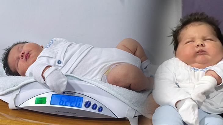 37 Haftalık Sezaryenle Doğan, Türkiye’nin En Büyük Bebeklerinden Ali Atilla