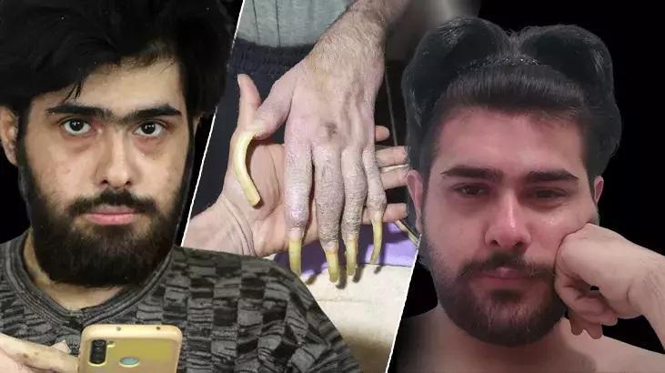 Barış Özbay’ın Sosyal hayata dönüş süreci ve Bakanlık müdahalesi sonrası gelişmeler