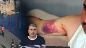 Çermik’te Aile İçinde Meydana Gelen Şiddet Olayı: Dayı-Talebe Darp Haber Özeti