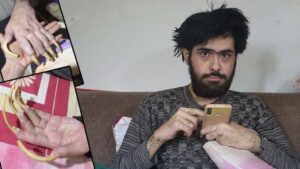 Deprem Sonrası Hayata Döndürülmeye Çalışılan Genç: 3 Yıldır Evden Çıkmayan Barış ve Ailesinin İçten Mücadele Hikayesi