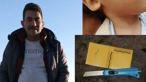 Eskişehir’de Şoke Eden Olay: Boğaz Kesme ve Ev Yangınıyla İlgili Dava