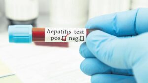 Hepatit Elimini Hedefleyen Küresel ve Türkiye Odaklı Değerlendirme