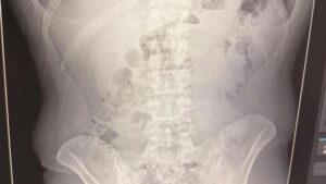 İran’dan Türkiye’ye Uyuşturucu Girişimini Önleyen Operasyonun Detayları