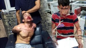 Vedat Kurt’ün İşkenceyle İlgili Dava Süreci ve Savunmalarının Özeti