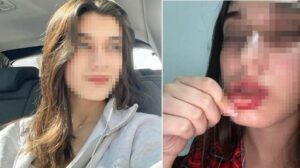 Atakum’da Olay: İki Taraf Şikayetçi, Soruşturma Devam Ediyor