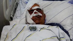 Ayı Saldırısında Yüz Yaralanması Yaşanan Hadise: Halit Zengel’in Hastane Yolculuğu