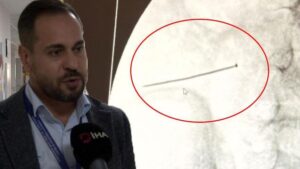 Çocuk Sağlığı İçin Kritik Uyarı: İnce Bağırsakta Delinmeye Neden Olan Yaklaşık 3 Santimlik Toplu İğne Olayı