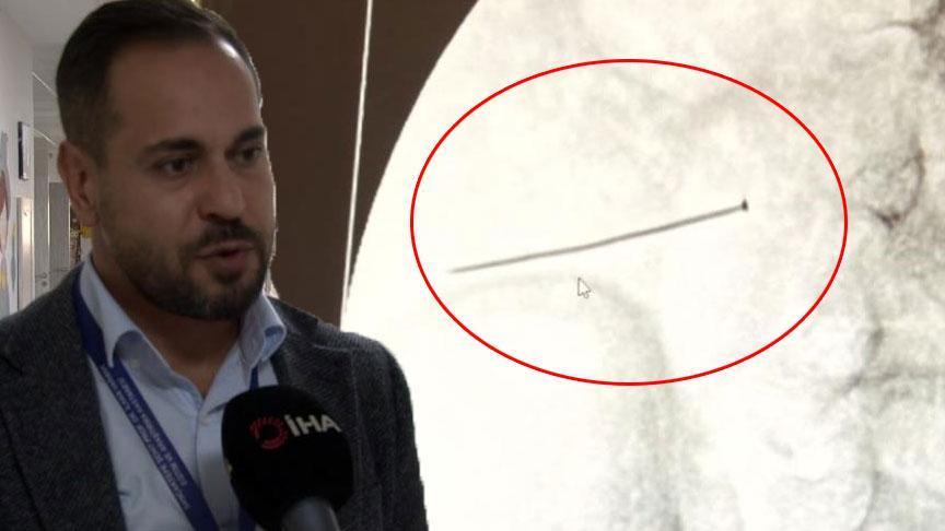 Çocuk Sağlığı İçin Kritik Uyarı: İnce Bağırsakta Delinmeye Neden Olan Yaklaşık 3 Santimlik Toplu İğne Olayı