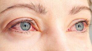 Diyabet ve Göz Sağlığı: Erken Tanı ve Düzenli Kontrollerin Hayati Önemi