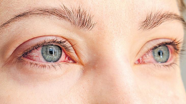 Diyabet ve Göz Sağlığı: Erken Tanı ve Düzenli Kontrollerin Hayati Önemi