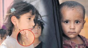 İklim Değişikliğinin Sağlık Üzerindeki Yansımaları ve Türkiye için Stratejiler: Uzman Görüşleriyle Derinleştirme