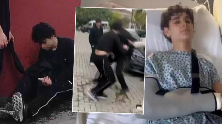 Kavga Anı Kamerada: Liseli Öğrencinin Kolundan Yaralanması Olayı