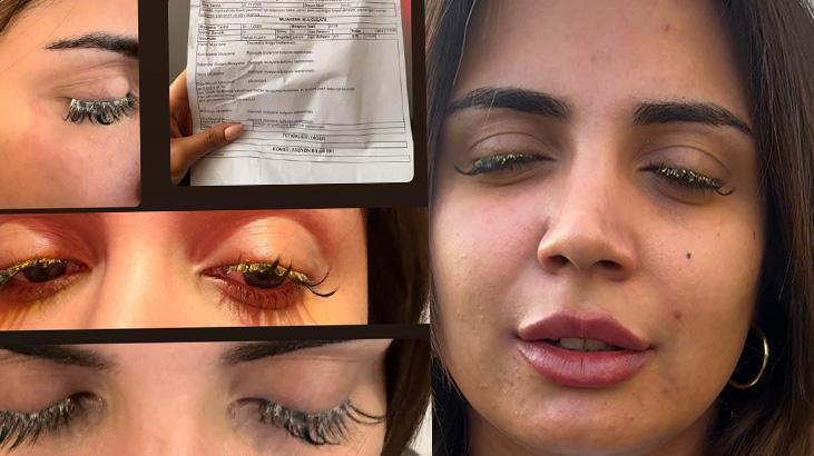 Kirpik Lazerinde Yaşanan Felakete Dair: Çalışanlar Sorumluluğunu Üstlendi