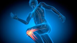 Menisküs Yırtıkları ve Tedavi Yaklaşımları: Cerrahiye mi Çağırır, Yoksa Rehabilitasyonla mı İlerlenir?