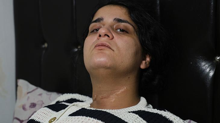 Nazmiye Çalışkan’a Yönelen Şiddet: 96 Yüzde Engelli Hayat ve Devlet Koruması