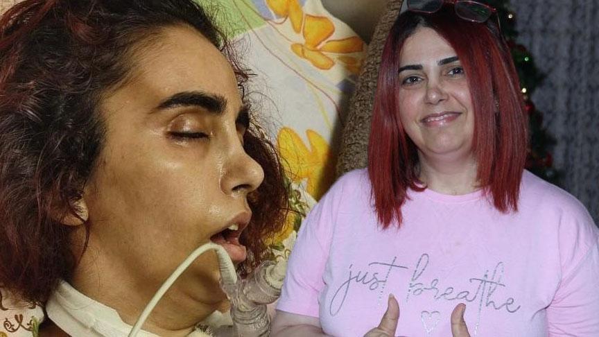 Yaşama Umut Olarak Yeniden Doğan Türkan Toprak: Ağır Trafoların Ardındaki İyileşme Hikayesi