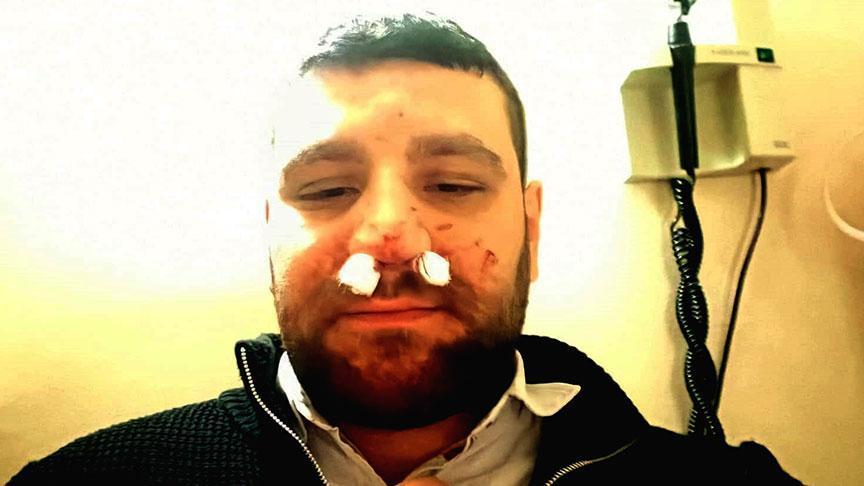 Yenimahalle’deki Kavgada Avukat ve Şoföre Özelleştirilmiş Şikayetler: Darp ve Körfez Tehditleri