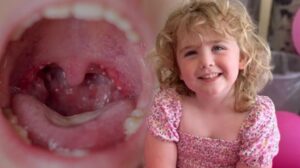 Amber Milnes: Bademcik ve Geniz Eti Ameliyatı Sonrası Yaşananlar ve Kusma Sendromunun İşaretleri