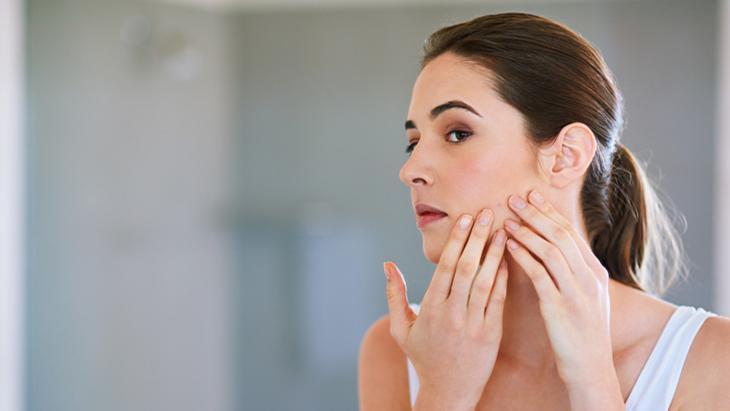 BBL Lazer ile Akne ve İzlerinde Güçlü ve Konforlu Tedavi Yaklaşımı