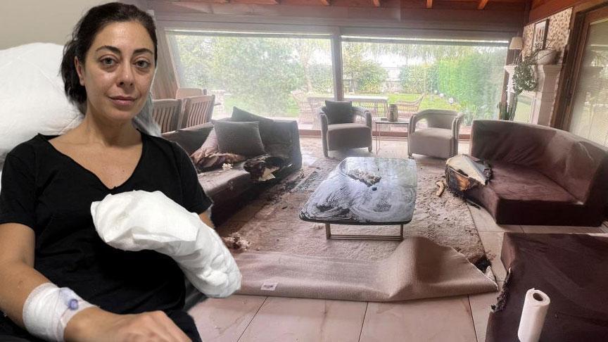 Dekoratif Şömine Faciası: Yangın ve Yanık Hikayesi – Derya Yavaş’ın Yaşadığı Olayın Ayrıntıları