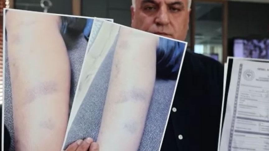 Diyarbakır Özel Okulunda Çocuk Darp Olayı: Tanıklıklar, Kamera Kayıtları ve Okul Açıklaması